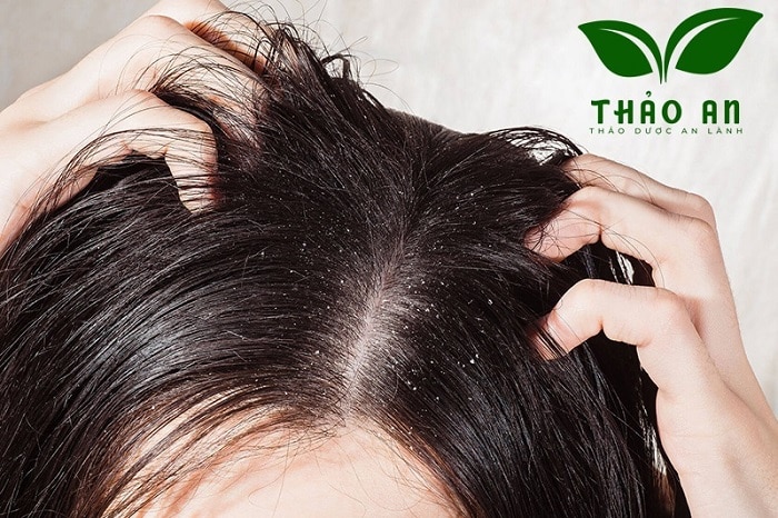 Dùng dầu gội đầu hết hạn