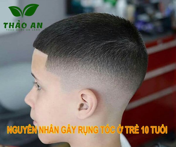 nguyên nhân rụng tóc ở trẻ em 10 tuổi 3