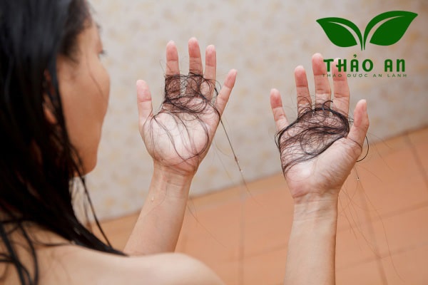 Rụng tóc hậu COVID